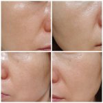 kem dưỡng trắng da Varihope 8 Days Pure Vitamin C Cream 7%