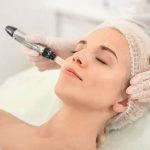 có nên trị nám bằng laser không